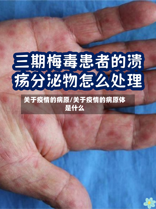 关于疫情的病原/关于疫情的病原体是什么